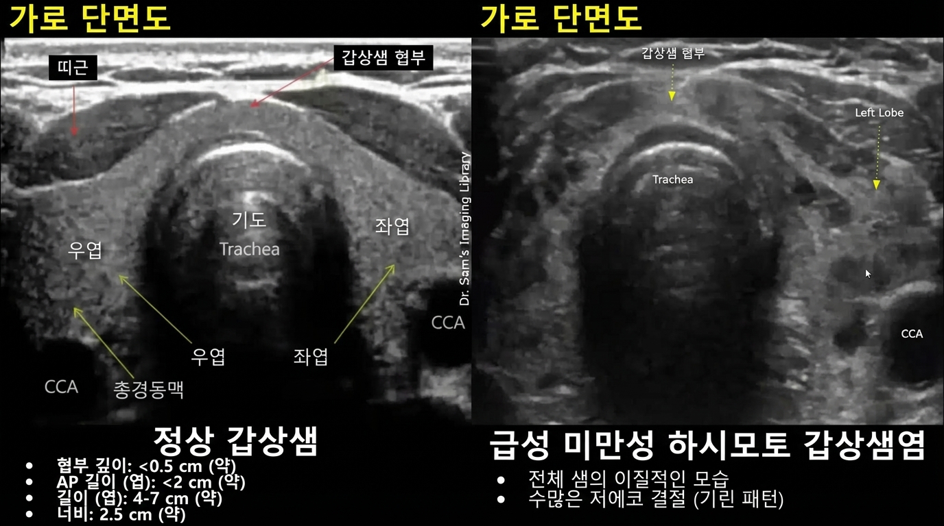 검사 결과 요약 카드 2