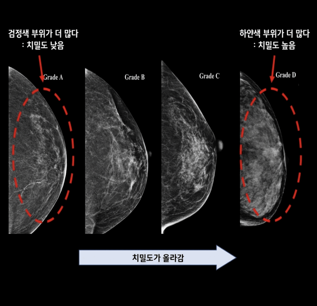 검사 결과 요약 카드 2