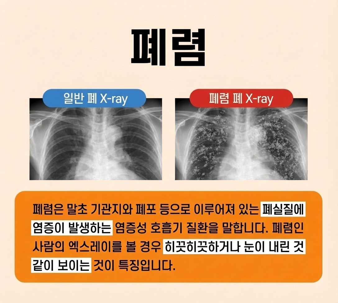 검사 결과 요약 카드 1