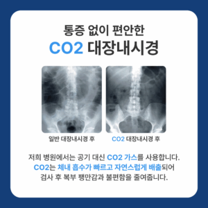 통증 없는 CO2 대장내시경 시행