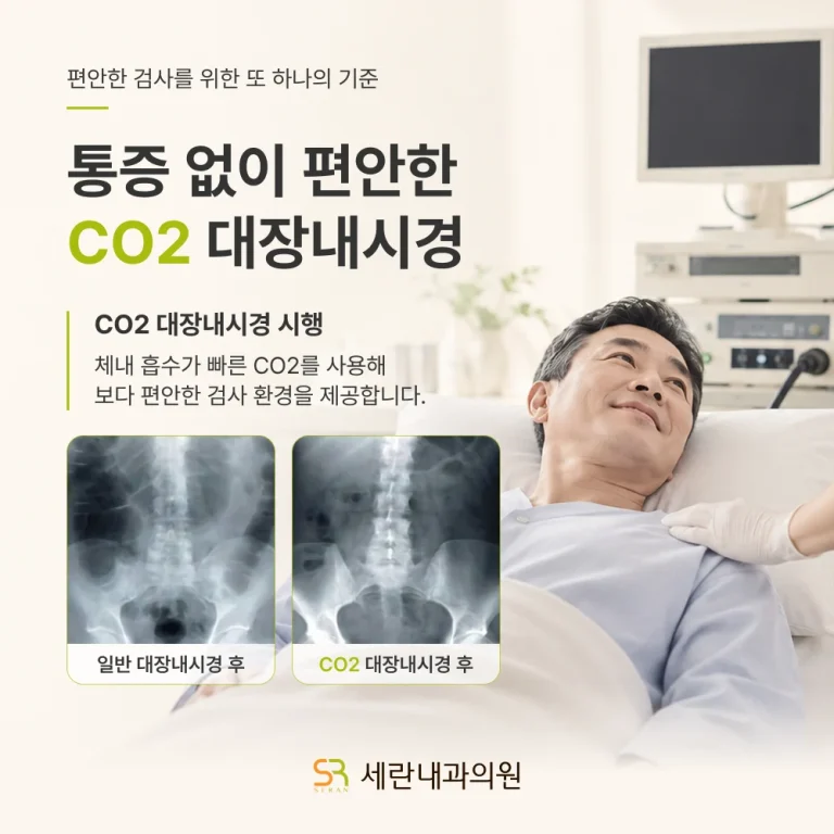 통증 없는 CO2 대장내시경 시행