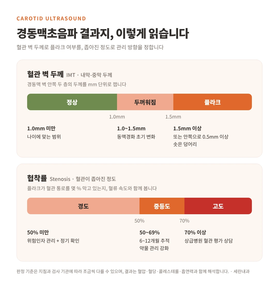경동맥초음파 결과지 판정 기준 인포그래픽. 혈관 벽 두께 1.0mm 미만 정상, 1.0~1.5mm 두꺼워짐, 1.5mm 이상 플라크. 협착률 50% 미만 경도, 50~69% 중등도, 70% 이상 고도